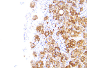 reactivo anticuerpo monoclonal 1