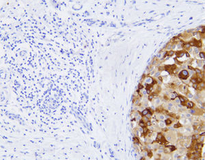 reactivo anticuerpo monoclonal 1