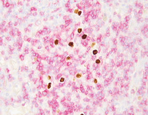 kit de prueba para enfermermedades infecciosas