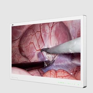 monitor para endoscopia 1