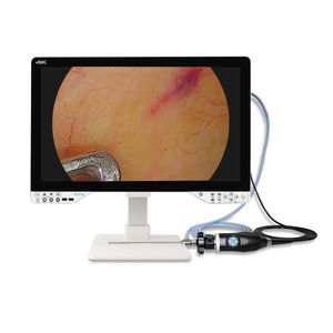 cámara para endoscopio 1