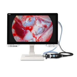 cámara para endoscopio 1