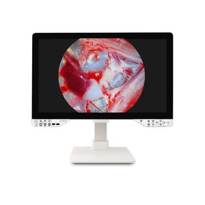 cámara para endoscopio
