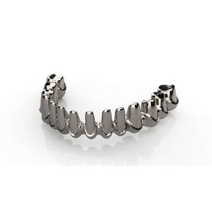 puente dental de metal 1