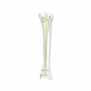 clavo intramedular para tibia 1