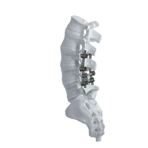 sistema de osteosíntesis lumbar