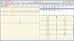 software para EEG