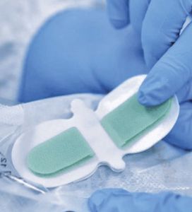 fijador de catéter para catéter intravenoso