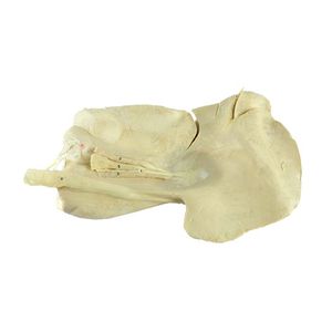 modelo anatómico de hígado 1