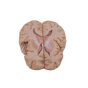 modelo anatómico de cerebro 1