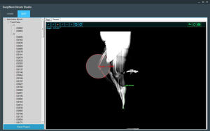 software de visualización DICOM