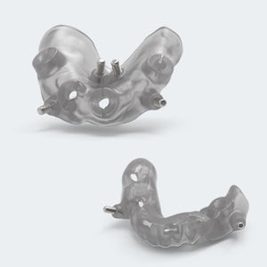guía quirúrgica para odontología 1