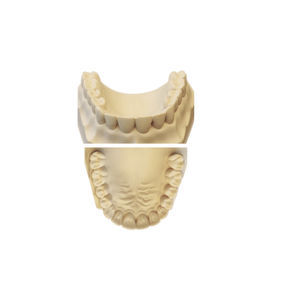 material dental de resina 1