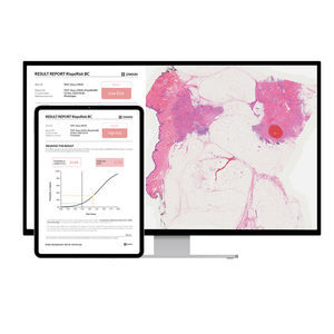 software para detección del cáncer de mama