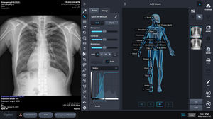 software de radiografía