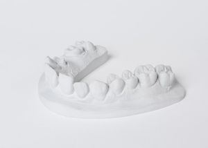 material dental de piedra 1