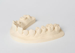 material dental de piedra 1