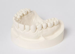 material dental de piedra 1