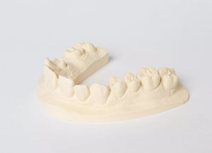 material dental de piedra 1