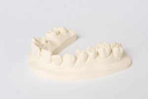 material dental de piedra