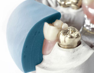 material dental de silicona 1