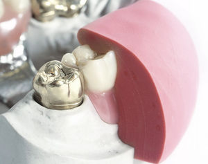 material dental de silicona 1