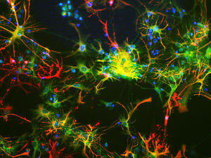 reactivo anticuerpo monoclonal 1