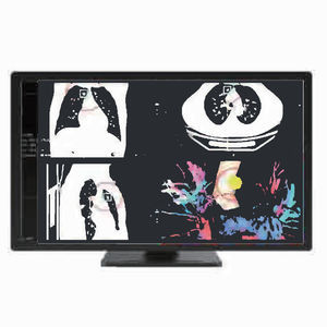 monitor de diagnóstico