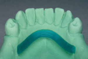 material dental cera 1