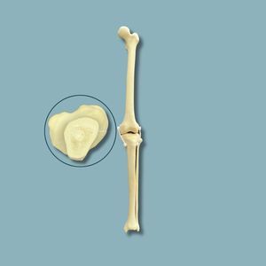 modelo anatómico de rodilla