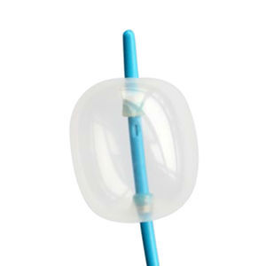 catéter de extracción de cálculos 1