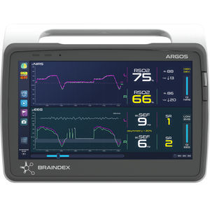 sistema de monitorización para EEG