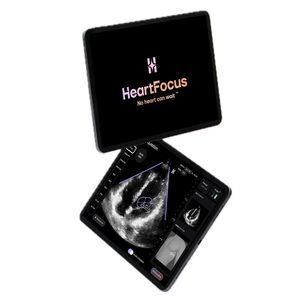 aplicación para móviles para ecocardiografía