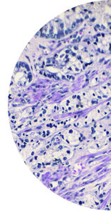 kit de prueba de oncología