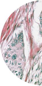 kit de prueba de cáncer colorrectal