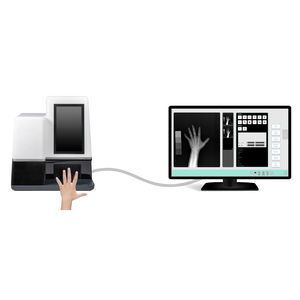 sistema de radiografía
