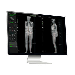 plataforma de IA para el sector médico