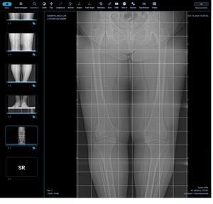 módulo de software de medición