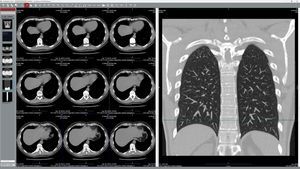 software de visualización DICOM 1