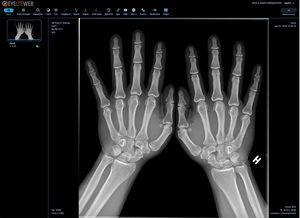 módulo de software de visualización DICOM 1