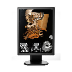 monitor de diagnóstico