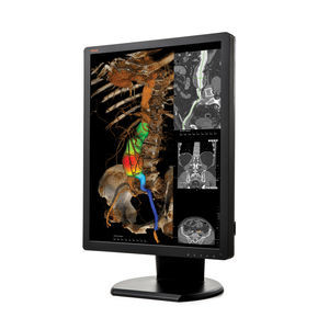 monitor de diagnóstico