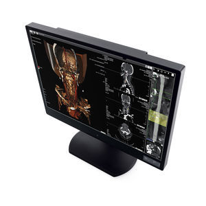monitor de diagnóstico