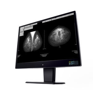 monitor de diagnóstico