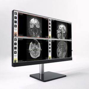 monitor para imágenes médicas