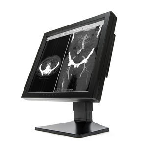 monitor de diagnóstico