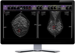 plataforma de IA para hospitales