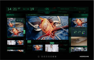sistema de integración de trazado
