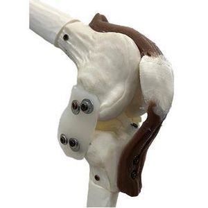 fantoma de rodilla