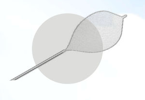 cesta endoscopica para la extracción de pólipos intestinales
